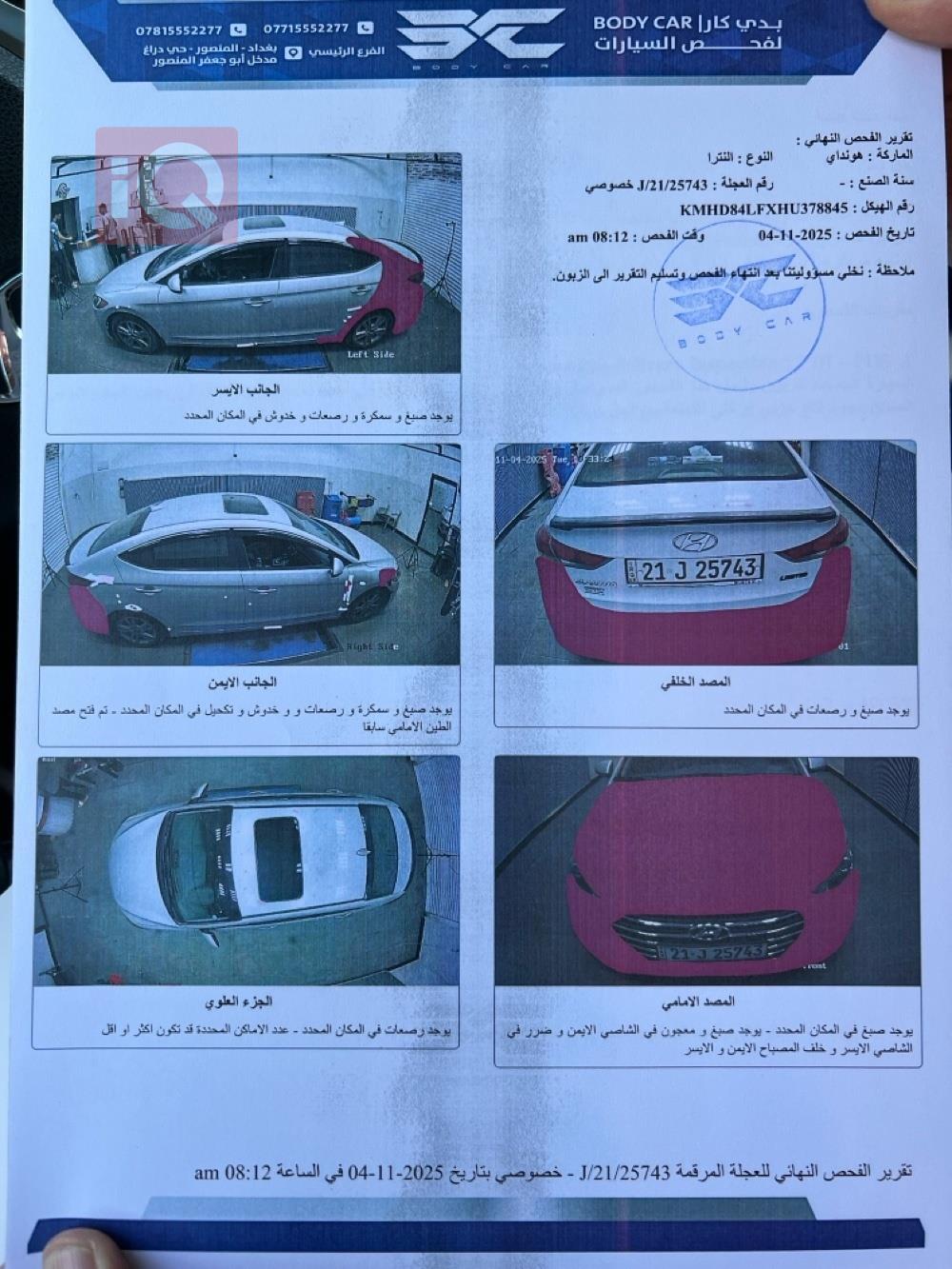 هيونداي النترا